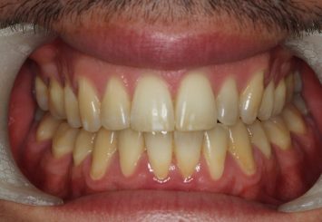 After - Orthodontics