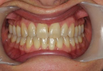 After - Orthodontics