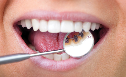 Treatment - Orthodontics